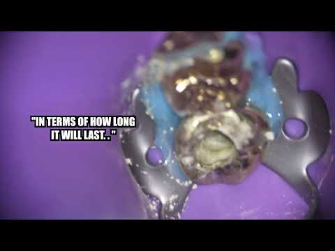 Video: Popraskaný nebo shnilý kořen tuřínu – jak opravit praskání tuřínu
