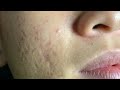 Satisfying Relaxing with Huong Da Nang Video #262