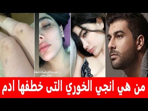 بعد اتهام آدم بخطفها   من هي إنجى خوري التي أثارت الجدل على السوشيال ميديا؟