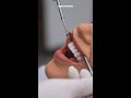 The Art of Smile Design | Renata’s Transformation Journey