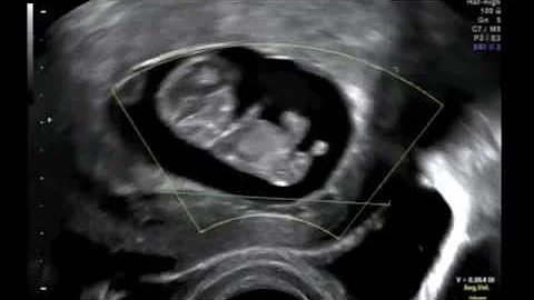 Quanti mesi sono 10 settimane in gravidanza?