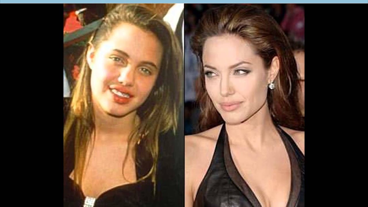 celebrity before and after