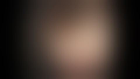 Endoscopic full-thickness resection of gastric gastrointestinal stromal tumor