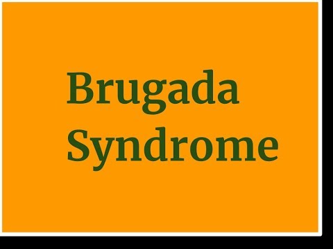 Wideo: Syndrom Brugady: Co To Jest, Przyczyny, Leczenie I Nie Tylko