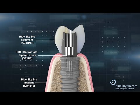 Blue Sky Bio marketing explainer by Advids