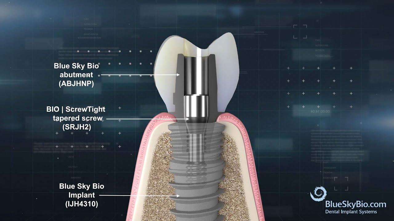 patientpop 3d health explainer-