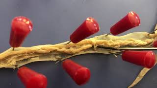 Ascaris Dissection Video