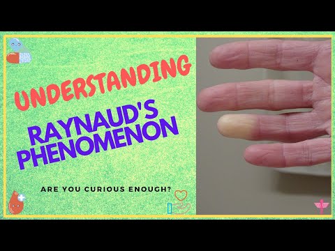 Raynaud&rsquo;s Phenomenon - 15 Things You Should Know