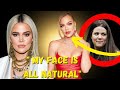 Khloe Kardashian SHOCKS Fans With New Face! Unrecognizable Yet Again