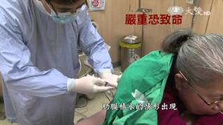 【志為人醫守護愛】預告 - 20151014 - 奪命殺手肺炎