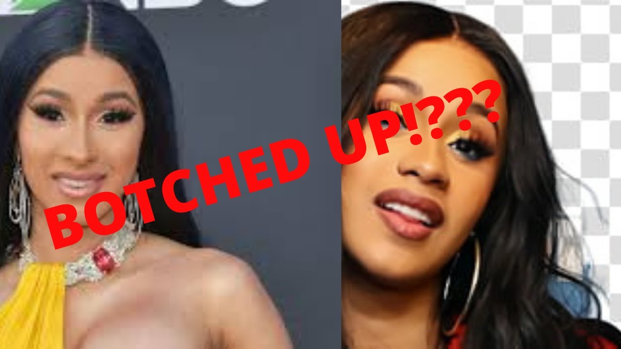 Cardi b apparently got BOTCHED UP & took the internet by storm ...