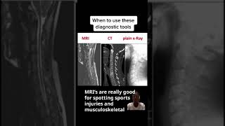 MRI, CT & x-ray scans | When to use what? | Lecturio screenshot 4