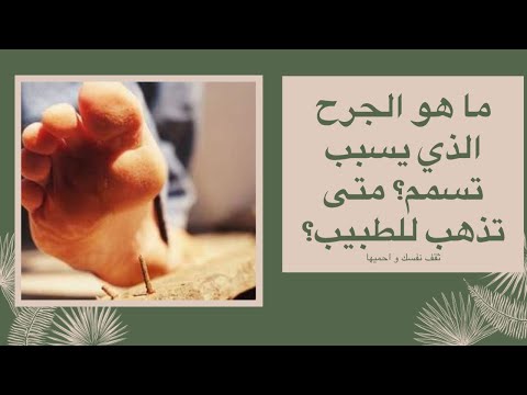 ما هو الجرح الذي يسبب تسمم ابرة التسمم التايتنوس