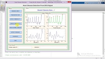 Heart Disease Detection from ECG Signal Matlab Project Code | Heart Disease Prediction Using Matlab