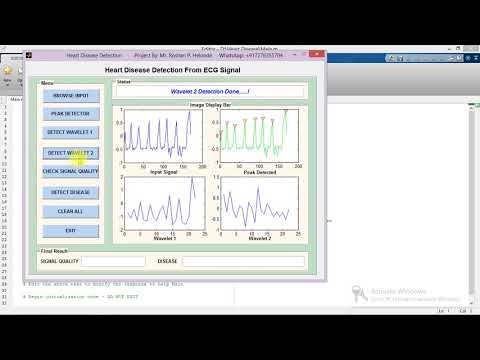 Heart Disease Detection from ECG Signal Matlab Project Code | Heart Disease Prediction Using Matlab