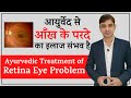 Ayurvedic treatment for retina eye problems          