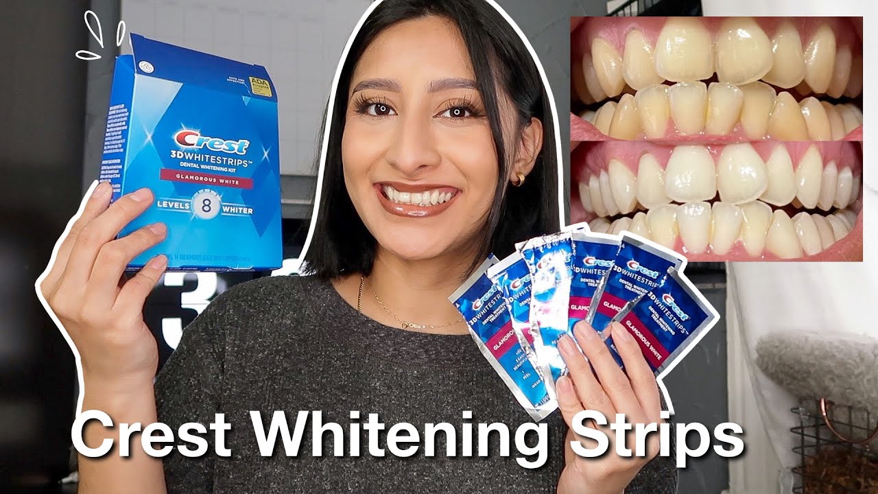 I TRIED THE CREST 3D WHITESTRIPS FOR 14 DAYS *Effective* | Before & After  pictures - YouTube
