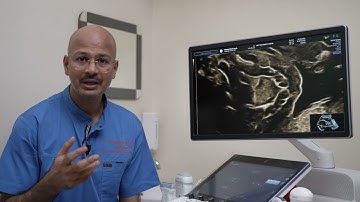 Voluson Expert 22 strong foundation with great 2D Imaging