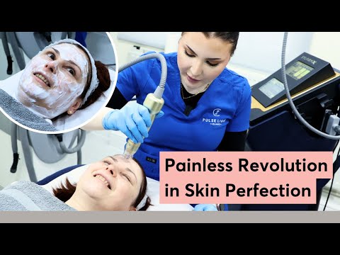 Shocking Beauty Secrets! Stunning Skin Results Painlessly with Sylfirm X