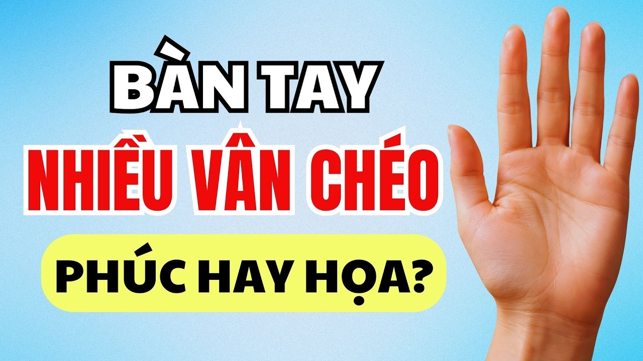 Người Có Lòng Bàn Tay Nhiều Vân Chéo: Số Phận Khác Thường Ít Ai Ngờ