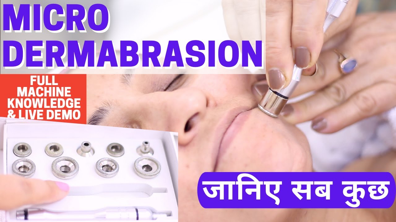 Micro Dermabrasion Facial, जानिए सब कुछ E44 YouTube
