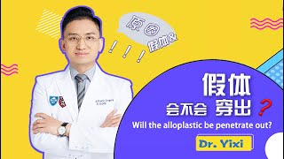 After Augmentation Rhinoplasty, Will The Alloplastic Be Penetrate Out
