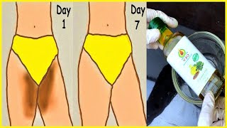 How to Lighten Private Areas Naturally Instantly ! 100% Works at home !! Dr Heng Soy