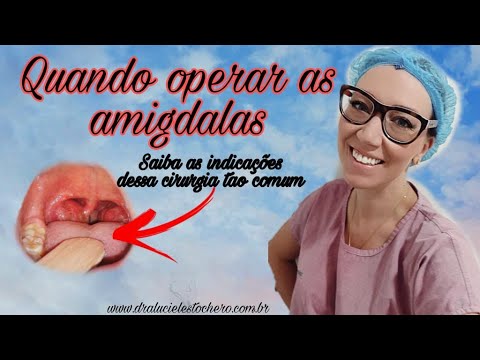 Vídeo: As amígdalas normais se parecem?