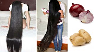 How long hair grows and thicken with onions and potatoes !! Super fast hair growth challenge!