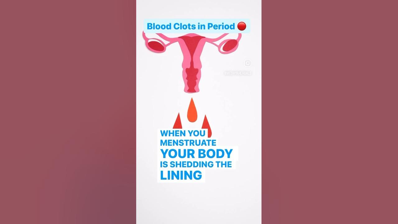 What Causes Blood Clots in Period? 🛑 YouTube