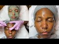 Dermaplaning + Brightening Facial Treatment | LiaLeigh