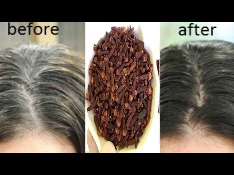 Video: 3 veidi, kā atbrīvoties no baltiem matiem