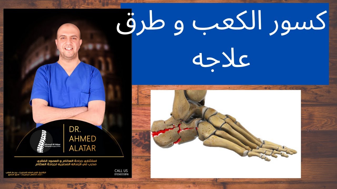 كسور الكعب و طرق علاجه - للدكتور احمد العطار
