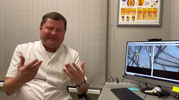 Какие анализы сдавать, чтобы понять причину выпадения волос? 🤔