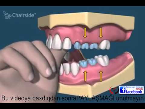 Video: Köpəyinizin Dişləri Haqqında 5 Maraqlı Fakt