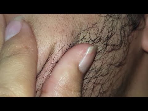 Asmr hair Satisfying | Deep scratching hair ASMR sounds | Hair care treatment 