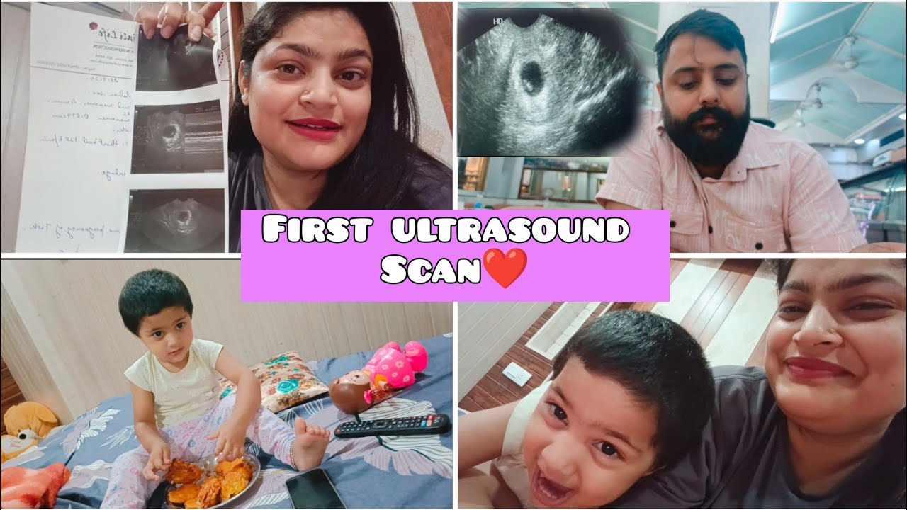 First ultrasound scan👶|| 7 week pregnancy scan ||Heart beat ,Seeing