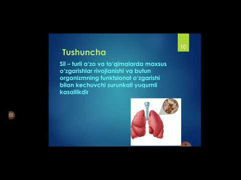 Tuberkulyoz xaqida ta’limotning rivojlanish tarixi  Tuberkulyoz etiologiyasi  Tuberkuloz epidemiolog