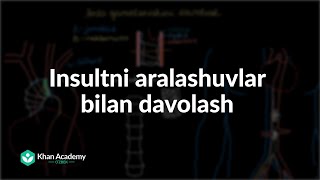 Insultni aralashuvlar bilan davolash | Insult | Tibbiyot