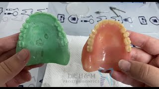 Copy denture (Arabic narration)