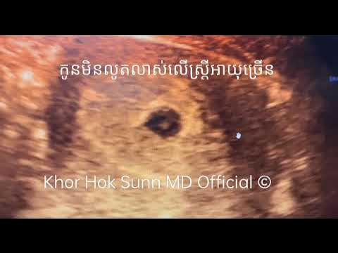 Mum talqini boyicha azo