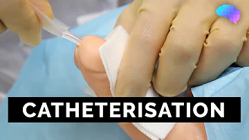 Comment mettre une tige urètre ? Comment mettre une tige urètre ?