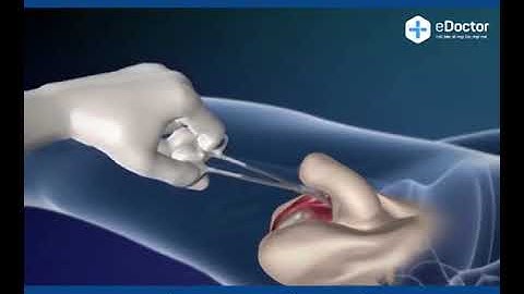 Quá Trình Phẩu Thuật Chuyển Giới Từ Nam Sang Nữ