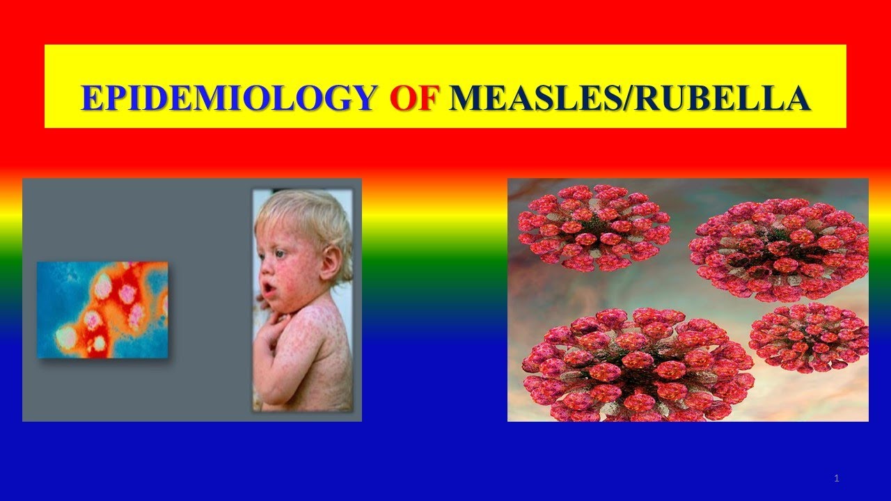 EPIDEMIOLOGY OF MEASLES / RUBELLA Definition, epidemiological