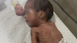 NICU newborn care |  Specific topics |  Premature baby support |
