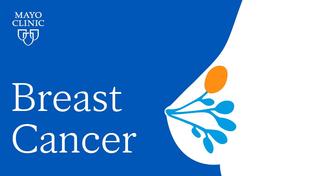 Hereditary Breast Cancer - Mayo Clinic