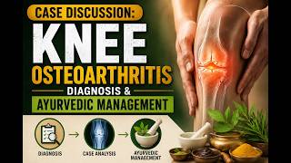 Osteoarthritis in Knee - Case Based Management Series - 1