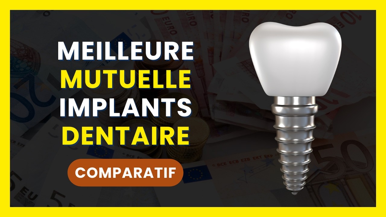 Quelle est la Meilleure MUTUELLE pour IMPLANT DENTAIRE ? | COMPARATIF : Mutuelle Santé Implants Dent