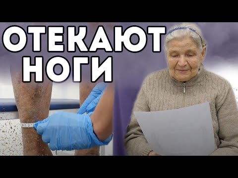 Отекают ноги к вечеру. Полная консультация флеболога + УЗИ