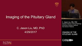 Imaging of Pituitary Gland by C. Jason Liu, MD | Preview